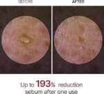 Dr.Melaxin, Peel Shot Glow White Rice Peeling Ampoule - Image 5